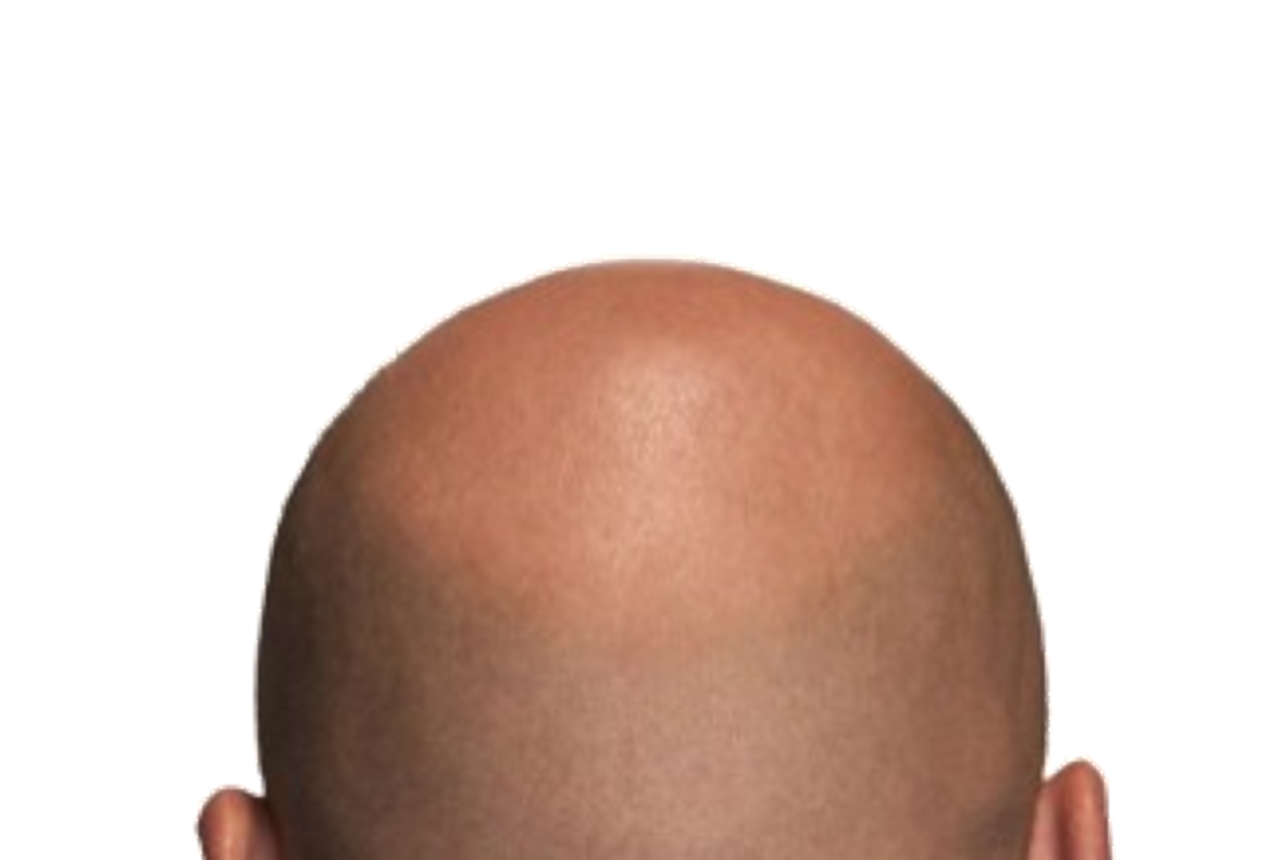 Башка нету. Затылок это анфас?. Человек с пустой головой. Пустота мем. Башка нету.